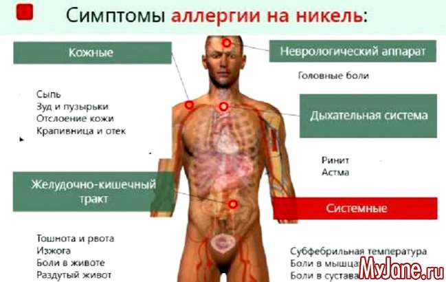 Алергія на метал: не тільки косметична проблема...