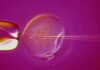 Why Women Choose Donor Eggs for Pregnancy