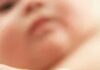 When Baby Skin Looks Wrong: What’s Normal and What Needs a Doctor